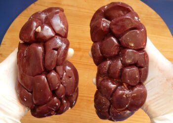 basics of human kidney function