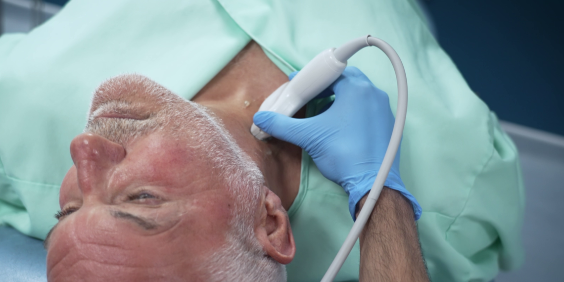 Simple Neck Ultrasound May Identify Heart Attack and Stroke Risks