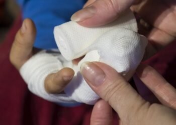 basics of first aid for common injuries