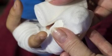 basics of first aid for common injuries