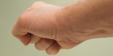 stress management techniques explained