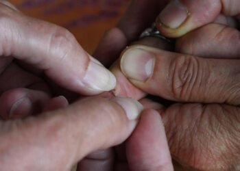 basics of first aid for common injuries