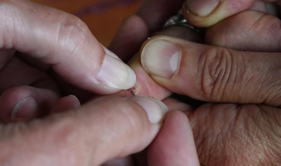 basics of first aid for common injuries