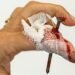 basics of first aid for common injuries