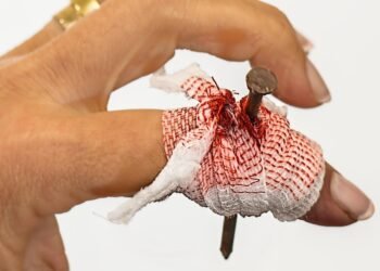 basics of first aid for common injuries