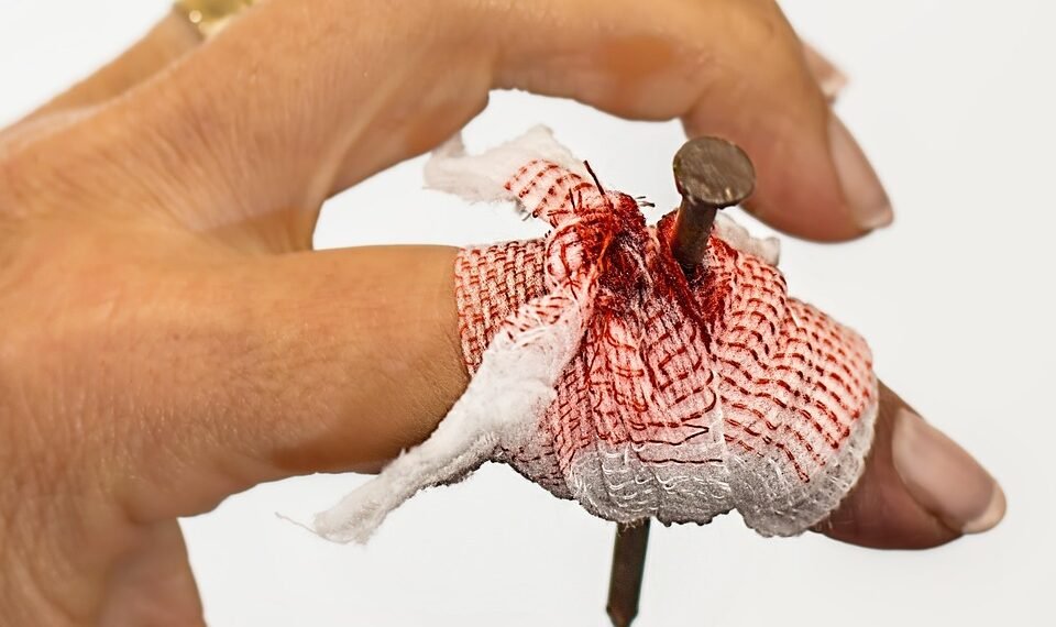 basics of first aid for common injuries