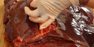 role of the liver in detoxification