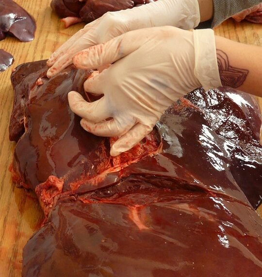 role of the liver in detoxification