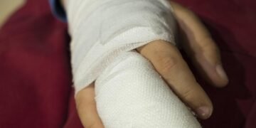 basics of first aid for common injuries