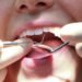 UK Dentists To Receive Increased Payments for Urgent Patient Care