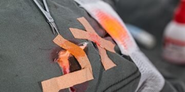 basics of first aid for common injuries
