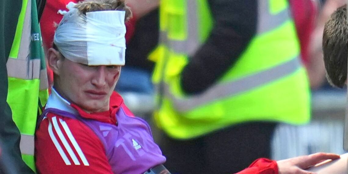 Aberdeen Supporter Jailed for Attacking Footballer Jack MacKenzie During Match