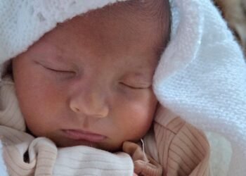 Home Treatment Options for Newborn Jaundice Explored in the UK