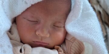 Home Treatment Options for Newborn Jaundice Explored in the UK