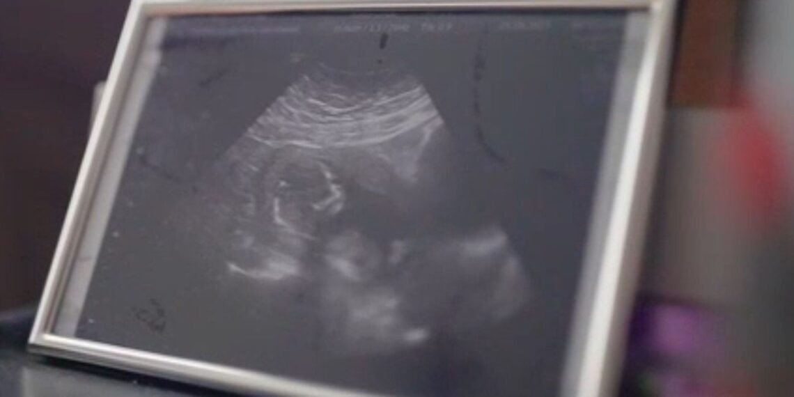 Mother Claims Pain Relief Denied During Labour Amid Nationwide Birth Story Push