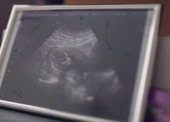 Mother Claims Pain Relief Denied During Labour Amid Nationwide Birth Story Push